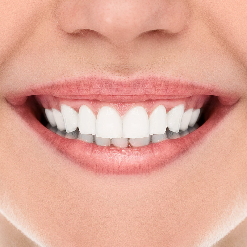 Estética Dental Arroio dos Ratos